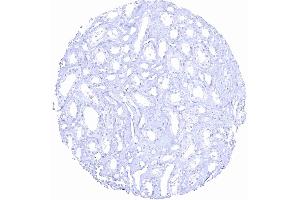 Kidney medulla (Rekombinanter Prostate Specific Antigen Antikörper  (AA 150-250))