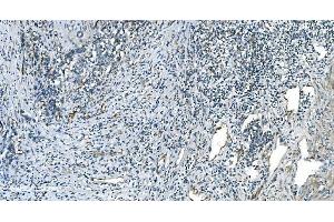 IHC analysis of H Cadherin/CDH13 using anti-H Cadherin/CDH13 antibody (ABIN7600095). (Cadherin 13 Antikörper  (AA 149-692))