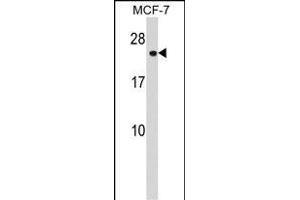 CHA Antibody (N-term) (ABIN1539304 and ABIN2848555) western blot analysis in MCF-7 cell line lysates (35 μg/lane). (CHMP1A Antikörper  (N-Term))