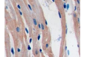 Detection of PDL1 in Rat Cardiac Muscle Tissue using Polyclonal Antibody to Programmed Cell Death Protein 1 Ligand 1 (PDL1) (PD-L1 Antikörper  (AA 34-241))