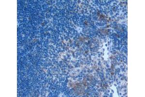 IHC-P analysis of Human Tissue, with DAB staining. (CCL3 Antikörper  (AA 27-92))