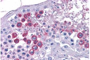 Human Testis: Formalin-Fixed, Paraffin-Embedded (FFPE) (ATP11A Antikörper  (N-Term))