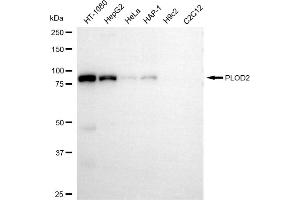 Western blotting analysis using PLOD2 antibody (ABIN7799903). (PLOD2 Antikörper)
