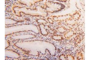 IHC-P analysis of Human Stomach Tissue, with DAB staining. (HNRNPA2B1 Antikörper  (AA 21-103))