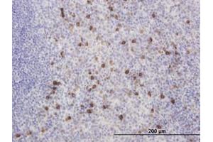 Image no. 3 for anti-Kv Channel Interacting Protein 2 (KCNIP2) (AA 1-100) antibody (ABIN466204) (KCNIP2 Antikörper  (AA 1-100))