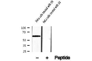 Western blot analysis of extracts of HeLa cells treated with UV, using Phospho-Smad1 (Ser206) Antibody.