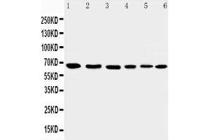 Anti-AIF antibody, Western blotting Lane 1: Rat Heart Tissue Lysate Lane 2: Rat Brain Tissue Lysate Lane 3: K562 Cell Lysate Lane 4: HEPG2 Cell Lysate Lane 5: A431 Cell Lysate Lane 6: NIH3T3 Cell Lysate (AIF Antikörper  (C-Term))