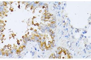Immunohistochemistry (Paraffin-embedded Sections) (IHC (p)) image for anti-Eukaryotic Translation Initiation Factor 2B, Subunit 2 Beta, 39kDa (EIF2B2) antibody (ABIN7262969)
