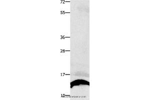 Western blot analysis of Human liver cancer tissue , using COX5B Polyclonal Antibody at dilution of 1:250