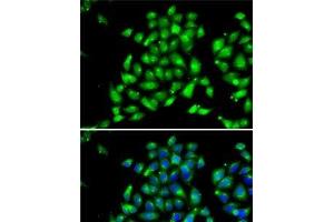 Immunofluorescence analysis of MCF7 cells using ARFGAP1 Polyclonal Antibody
