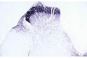 Immunohistochemical staining of Trpv2 in rat dorsal horn using Trpv2 polyclonal antibody . (TRPV2 Antikörper  (AA 744-761))