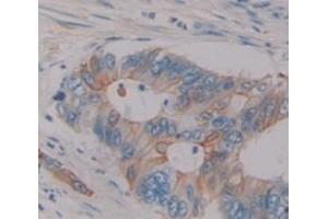 IHC-P analysis of Human Tissue, with DAB staining. (Sucrase Isomaltase Antikörper  (AA 1717-1827))