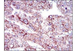 Immunohistochemistry (IHC) image for anti-Solute Carrier Family 27 (Fatty Acid Transporter), Member 5 (SLC27A5) (AA 508-570) antibody (ABIN1845743) (SLC27A5 Antikörper  (AA 508-570))