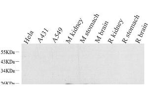 Western Blot analysis of various samples using NTS Polyclonal Antibody at dilution of 1:1000. (Neurotensin Antikörper)