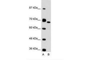 Image no. 1 for anti-Fibronectin 1 (FN1) (C-Term) antibody (ABIN6736615) (Fibronectin 1 Antikörper  (C-Term))