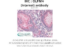 Image no. 2 for anti-Olfactomedin 4 (OLFM4) (Internal Region) antibody (ABIN1737637)