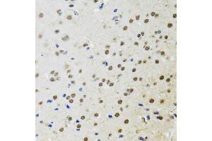 Immunohistochemistry of paraffin-embedded mouse brain using BTK antibody (ABIN3022170, ABIN3022171, ABIN3022172 and ABIN6218643) at dilution of 1:100 (40x lens). (BTK Antikörper  (AA 30-240))