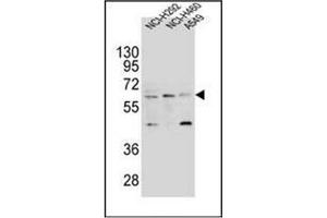 Western blot analysis of CD85h / LILRA2 Antibody (Center) in NCI-H292,NCI-H460 and A549 cell line lysates (35ug/lane). (LILRA2 Antikörper  (Middle Region))