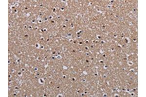 The image on the left is immunohistochemistry of paraffin-embedded Human brain tissue using ABIN7130211(MECP2 Antibody) at dilution 1/60, on the right is treated with fusion protein. (MECP2 Antikörper)