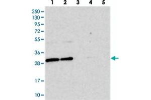 Western blot analysis of Lane 1: RT-4, Lane 2: U-251 MG, Lane 3: Human Plasma, Lane 4: Liver, Lane 5: Tonsil with BCDIN3D polyclonal antibody  at 1:250-1:500 dilution.