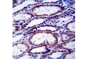 COL1A1 antibody immunohistochemistry analysis in formalin fixed and paraffin embedded human kidney tissue. (COL1A1 Antikörper  (AA 1077-1106))