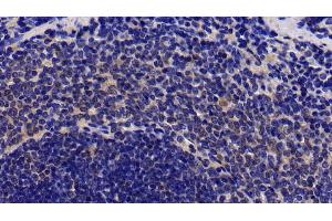 Detection of IL1R1 in Rat Spleen Tissue using Polyclonal Antibody to Interleukin 1 Receptor Type I (IL1R1) (IL1R1 Antikörper  (AA 226-352))