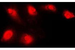 Immunofluorescent analysis of Histone Deacetylase 5 staining in Jurkat cells. (HDAC5 Antikörper  (C-Term))