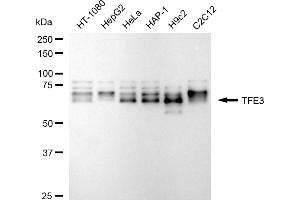 Western blotting analysis using TFE3 antibody (ABIN7800594). (Rekombinanter TFE3 Antikörper)