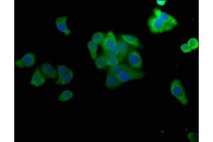 Immunofluorescence staining of HepG2 cells with ABIN7160070 at 1:50, counter-stained with DAPI. (MAP4K4 Antikörper  (AA 866-1104))