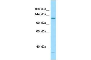 WB Suggested Anti-LAMC3 Antibody Titration: 1. (LAMC3 Antikörper  (C-Term))