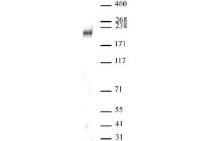 DOT1L antibody (pAb) tested by Western blot. (DOT1L Antikörper  (C-Term))