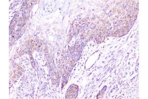 IHC analysis of cortactin using anti-cortactin antibody (ABIN6719306).