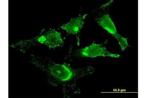 Immunofluorescence (IF) image for anti-Golgi Membrane Protein 1 (GOLM1) (AA 302-401) antibody (ABIN565577)