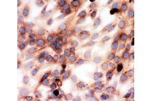 Immunocytochemistry (ICC) image for anti-Gelsolin (GSN) (AA 763-775) antibody (ABIN3031036)