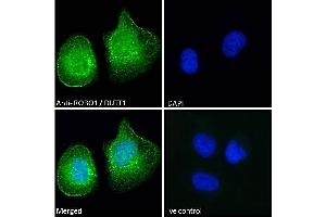 Immunofluorescence (IF) image for anti-Roundabout, Axon Guidance Receptor, Homolog 1 (ROBO1) (Internal Region) antibody (ABIN185537)
