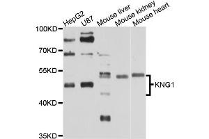 Western blot analysis of extracts of various cell lines, using KNG1 antibody (ABIN5970830) at 1/1000 dilution. (KNG1 Antikörper)
