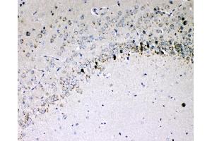 IHC analysis of IL-16 using anti-IL-16 antibody (ABIN5518927). (IL16 Antikörper  (AA 1205-1322))