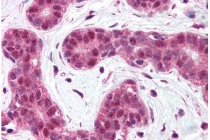 Human Breast (formalin-fixed, paraffin-embedded) stained with BCL10 antibody ABIN214584 at 5 ug/ml followed by biotinylated goat anti-rabbit IgG secondary antibody ABIN481713, alkaline phosphatase-streptavidin and chromogen. (BCL10 Antikörper  (N-Term))
