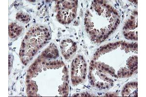 Immunohistochemical staining of paraffin-embedded Human breast tissue using anti-PDLIM2 mouse monoclonal antibody. (PDLIM2 Antikörper)
