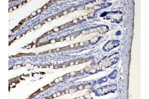 IHC testing of FFPE rat intestine tissue with CYP2D6 antibody at 1ug/ml.