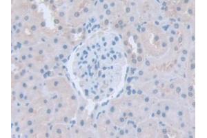 IHC-P analysis of Rat Kidney Tissue, with DAB staining. (ITSN1 Antikörper  (AA 1-227))