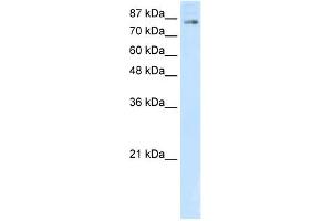WB Suggested Anti-SMARCA3 Antibody Titration:  5. (HLTF Antikörper  (C-Term))