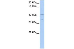 LASP1 antibody used at 1 ug/ml to detect target protein.