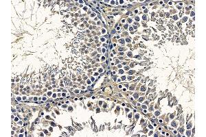 ABIN6257526 and ABIN6276229 at 1/100 staining rat testis tissue by IHC-P.