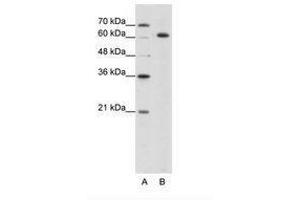 Image no. 2 for anti-Small Nuclear Ribonucleoprotein 70kDa (U1) (SNRNP70) (AA 21-70) antibody (ABIN203140)