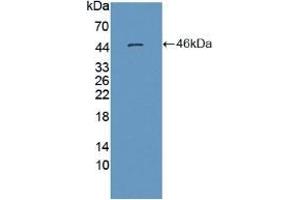 Detection of Recombinant MSE, Human using Polyclonal Antibody to Enolase 3 (ENO3) (ENO3 Antikörper  (AA 1-391))