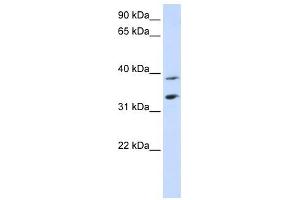 SLC25A34 antibody used at 1 ug/ml to detect target protein. (SLC25A34 Antikörper  (Middle Region))