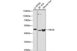 Western blot analysis of extracts of various cell lines using NR1I3 Polyclonal Antibody at dilution of 1:1000. (NR1I3 Antikörper)
