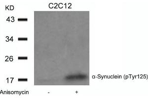 Western blot analysis of extracts from C2C12 cells untreated or treated with Anisomycin using a-Synuclein(Phospho-Tyr125) Antibody. (SNCA Antikörper  (pTyr125))