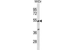 Western blot analysis in WiDr cell line lysates (35ug/lane) using PIGV  Antibody (C-term). (PIGV Antikörper  (C-Term))